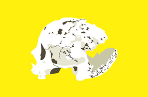 Syphilitic Skull